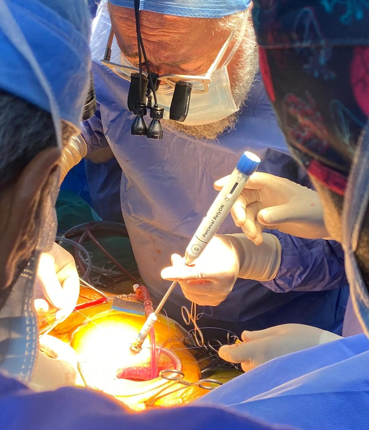 Türkiye’de bir ilk: Robotik aort kapak replasmanı başarıyla gerçekleştirildi