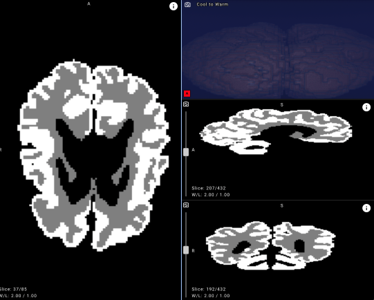 Yandex’in açık kaynak yapay zekâ aracı, bebeklerde serebral palsi belirtilerini yüzde 90’ın üzerinde doğrulukla tespit ediyor